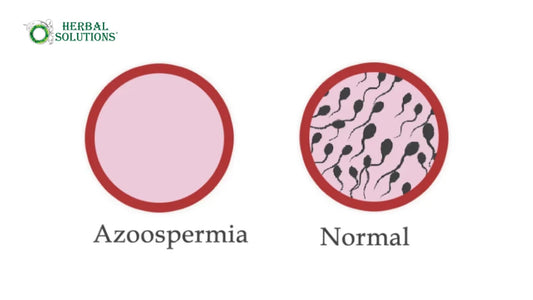 Natural Azoospermia Treatment: Your Complete Azoo Course Guide