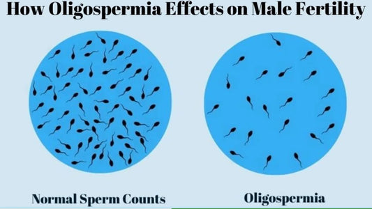 Oligospermia Causes & Treatment: Complete Guide to Low Sperm Count