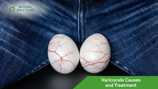 Varicocele: Symptoms, Causes & Natural Treatment Solutions Guide