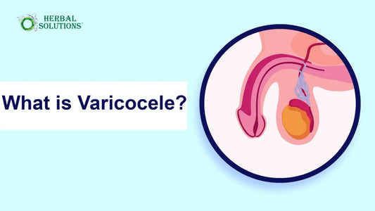Varicocele Treatment in Pakistan | Herbal Cure Without Surgery